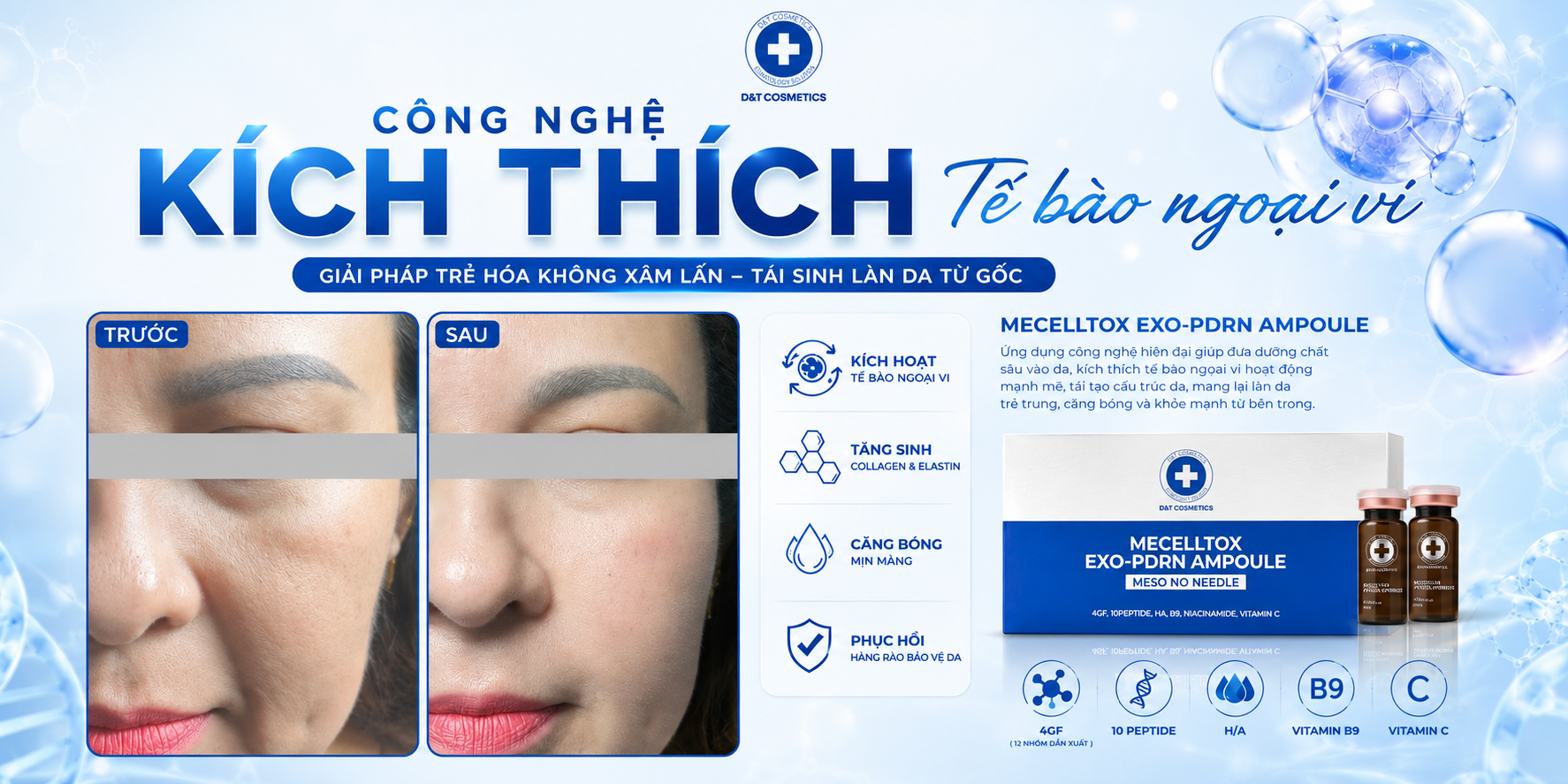bằng cách di chuyển một vật chỉ thị