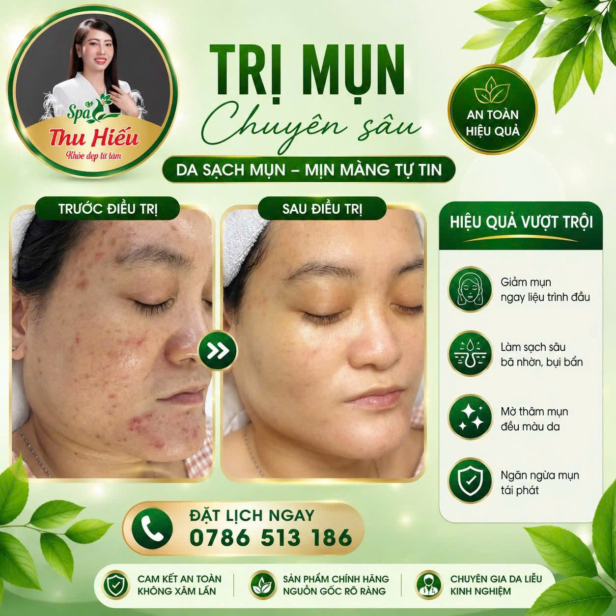 Chăm Sóc Da Tại Thu Hiếu Spa – Giải Pháp Cho Làn Da Khỏe Đẹp Từ Gốc