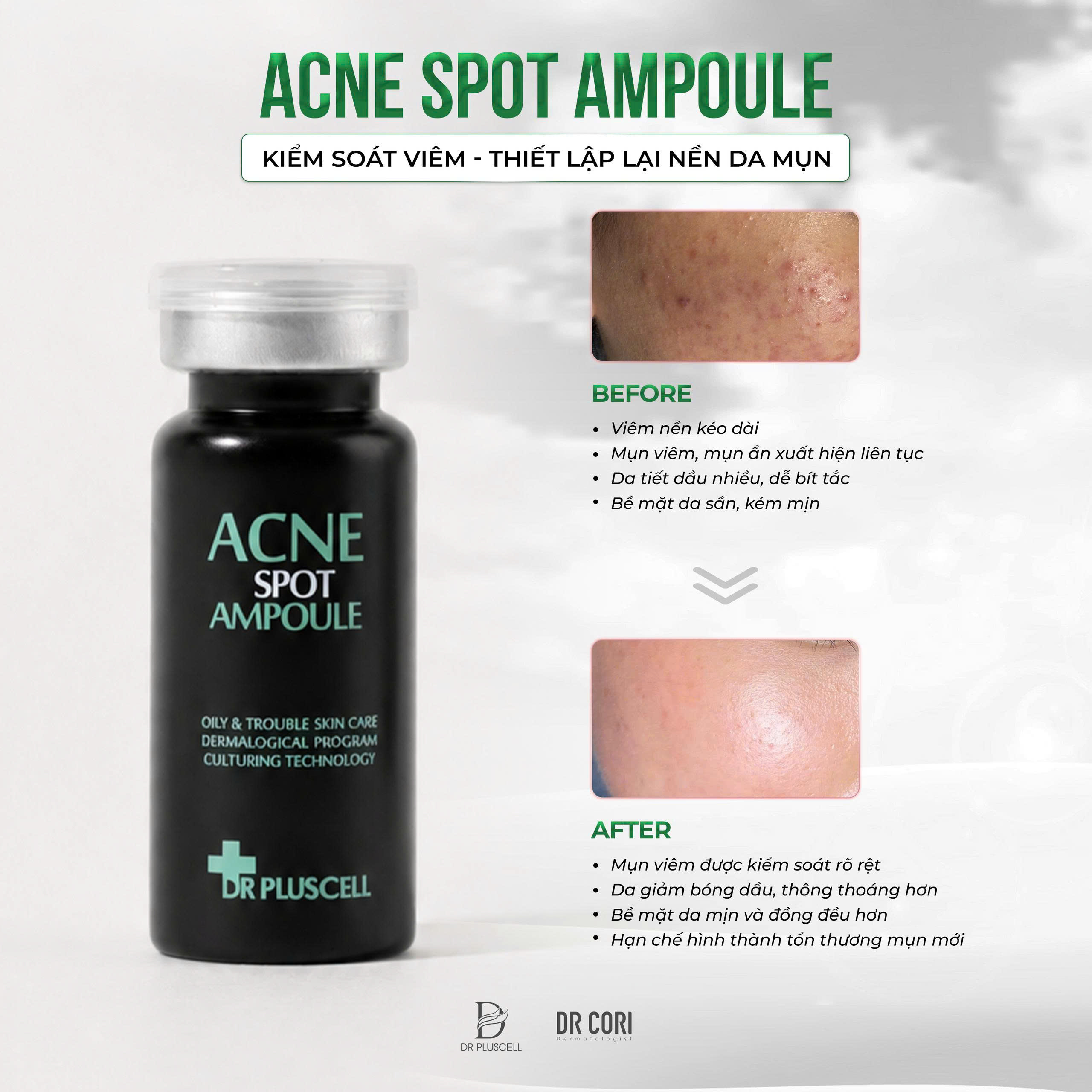 ACNE SPOT AMPOULE – KIỂM SOÁT VIÊM, THIẾT LẬP LẠI NỀN DA MỤN